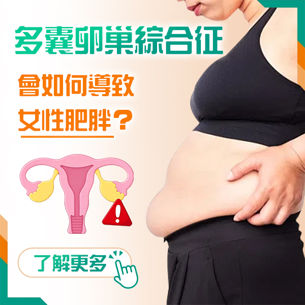多囊卵巢55.jpg